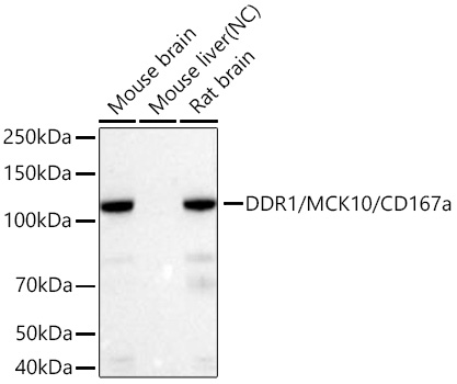 DDR1/MCK10/CD167a Monoclonal Antibody [8R8Z4]
