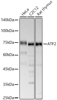 ATF2 Monoclonal Antibody [9T9M8]