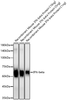 IFN-beta Monoclonal Antibody [1O1F5]