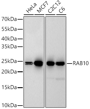 RAB10 Monoclonal Antibody [8I9Z4]