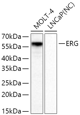 ERG Monoclonal Antibody [9N7K2]