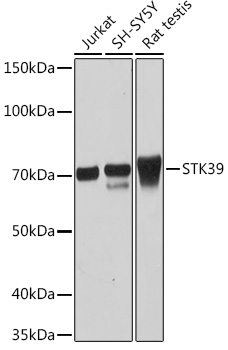 STK39 Monoclonal Antibody [0D9L5]