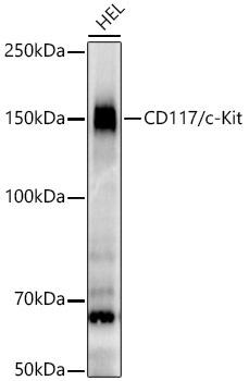 CD117/c-Kit Monoclonal Antibody