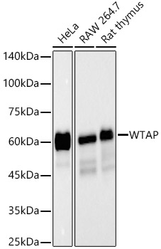 WTAP Monoclonal Antibody [1F5E1]