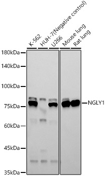 NGLY1 Monoclonal Antibody [7G3T10]