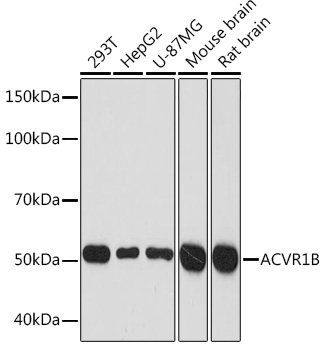 ACVR1B Monoclonal Antibody [3U6I8]