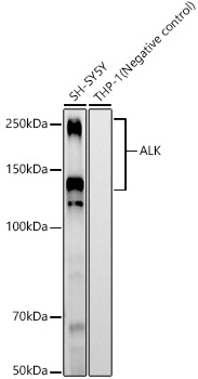 ALK Monoclonal Antibody [9Z8H9]