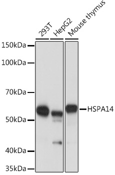 HSPA14 Monoclonal Antibody [4L1Z6]