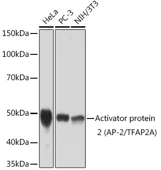 Activator protein 2 (AP-2/TFAP2A) Monoclonal Antibody [8I8E4]&nbsp;<img src="images/icon_newarrival.gif" alt="new" border="0">