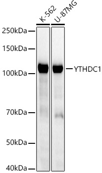 YTHDC1 Monoclonal Antibody [9M7W2]