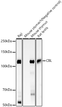CBL Monoclonal Antibody [1J1E3]