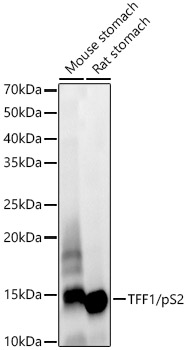 TFF1/pS2 Monoclonal Antibody [6F7A5]