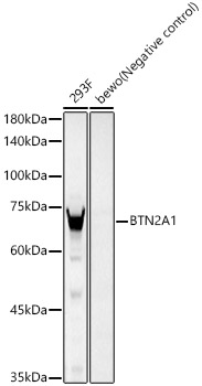 BTN2A1 Monoclonal Antibody [3S8U0]