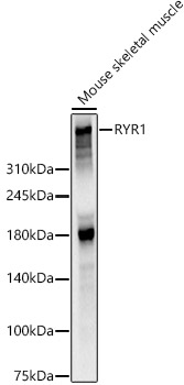RYR1 Polyclonal Antibody