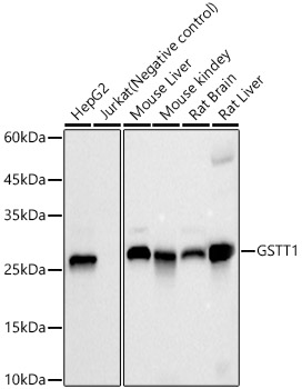 GSTT1 Monoclonal Antibody [2A7N6]