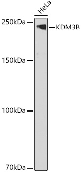 KDM3B Polyclonal Antibody