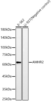 AMHR2 Monoclonal Antibody [7R5V8]