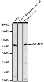 ADAMTS5 Monoclonal Antibody [1W9P3]&nbsp;<img src="images/icon_newarrival.gif" alt="new" border="0">