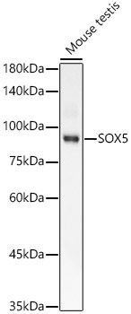 SOX5 Monoclonal Antibody [7W1J1]
