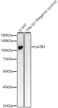 SATB1 Monoclonal Antibody [1W7F4]