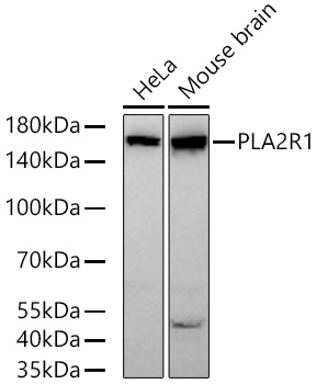 PLA2R1 Monoclonal Antibody [7I4Z1]