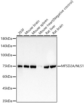 MFSD2A/NLS1 Monoclonal Antibody [8B10C6]