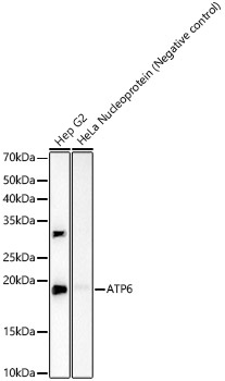 ATP6 Monoclonal Antibody [2W2R7]