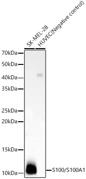 S100/S100A1 Monoclonal Antibody [6J1D8]