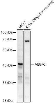 VEGFC Monoclonal Antibody [1A6T8]