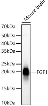 FGF1 Monoclonal Antibody [8C10P4]
