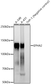 EPHA2 Monoclonal Antibody [2J5C10]