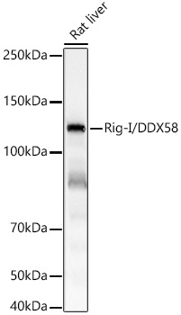 Rig-I/DDX58 Monoclonal Antibody [3E1C6]