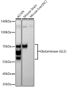 Glutaminase (GLS) Monoclonal Antibody [9U6B2]