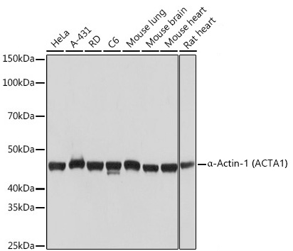 a-Actin-1 (ACTA1) Monoclonal Antibody [8T8D0]&nbsp;<img src="images/icon_newarrival.gif" alt="new" border="0">