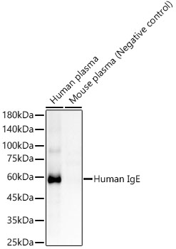 Human IgE Monoclonal Antibody [2F6A6]