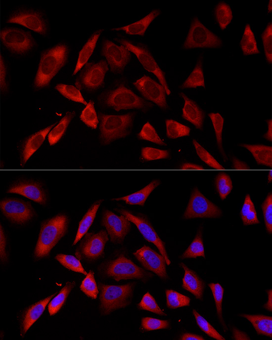 PKC alpha Monoclonal Antibody