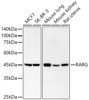 RARG Monoclonal Antibody [9K3Y1]