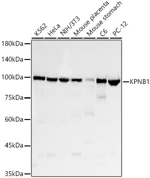 KPNB1 Monoclonal Antibody [2I7F5]