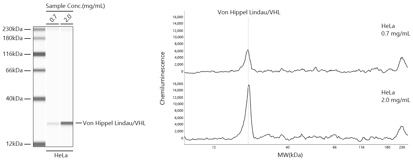 Von Hippel Lindau/VHL Monoclonal Antibody [5A8A9]