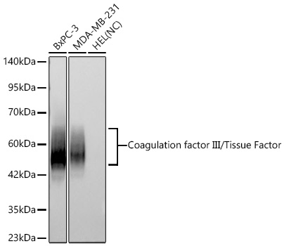 Coagulation factor III/Tissue Factor Monoclonal Antibody [9E8R6]