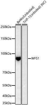 WFS1 Monoclonal Antibody [0J9H6]