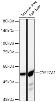 CYP27A1 Monoclonal Antibody [6L9D1]