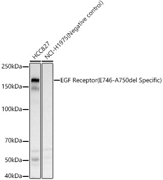 EGF Receptor (E746-A750del Specific) Rabbit Polyclonal Antibody