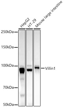 Villin1 Monoclonal Antibody [7M7H0]