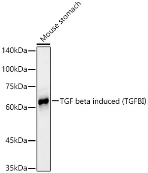 TGF beta induced (TGFBI) Monoclonal Antibody