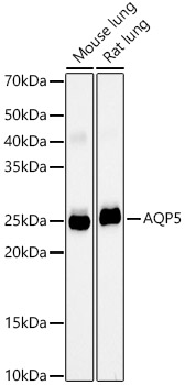 AQP5 Monoclonal Antibody [10V2Y1]