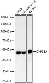 CYP51A1 Monoclonal Antibody [4Z9X10]