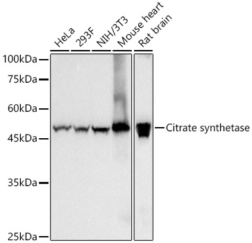 Citrate synthetase Monoclonal Antibody [6S7L8]