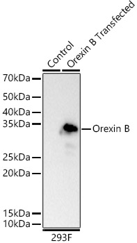 Orexin B Monoclonal Antibody [1E1J2]