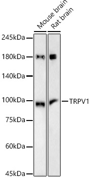 TRPV1 Monoclonal Antibody [10B2A1]